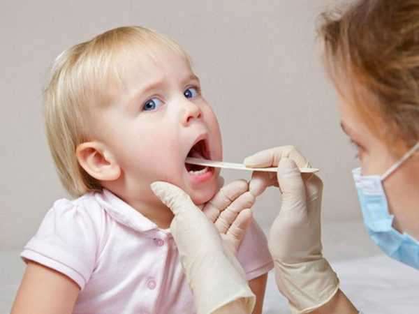 Viêm đường hô hấp cấp ở trẻ em